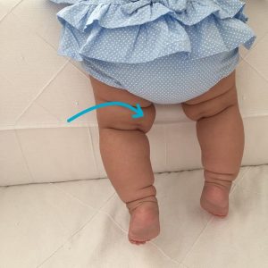 baby-sideknee